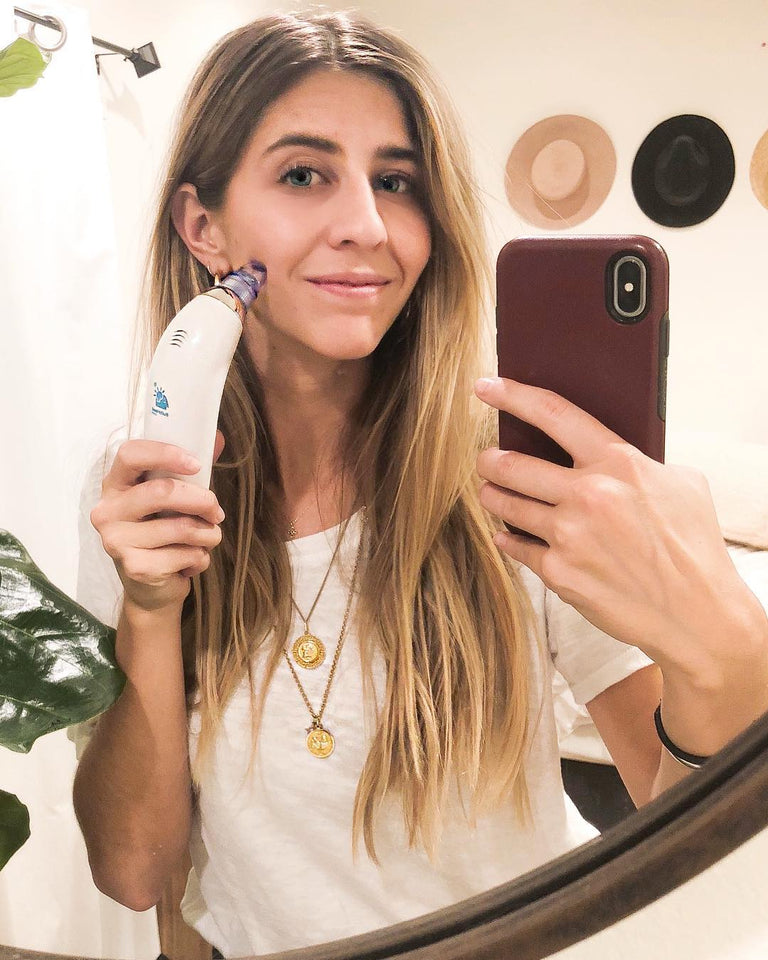 4 in 1 Derma Vacuum Suction Blackhead/Acne/Oil/Pore Cleaner 🌞💁♀️